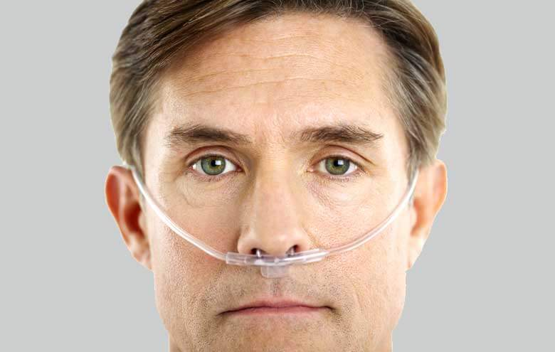 Nasal Cannula